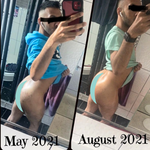 Butt Acne Treatment - Level 2 Mandelic Acid Serum