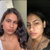 4 oz - Level 1 Mandelic Acid Serum