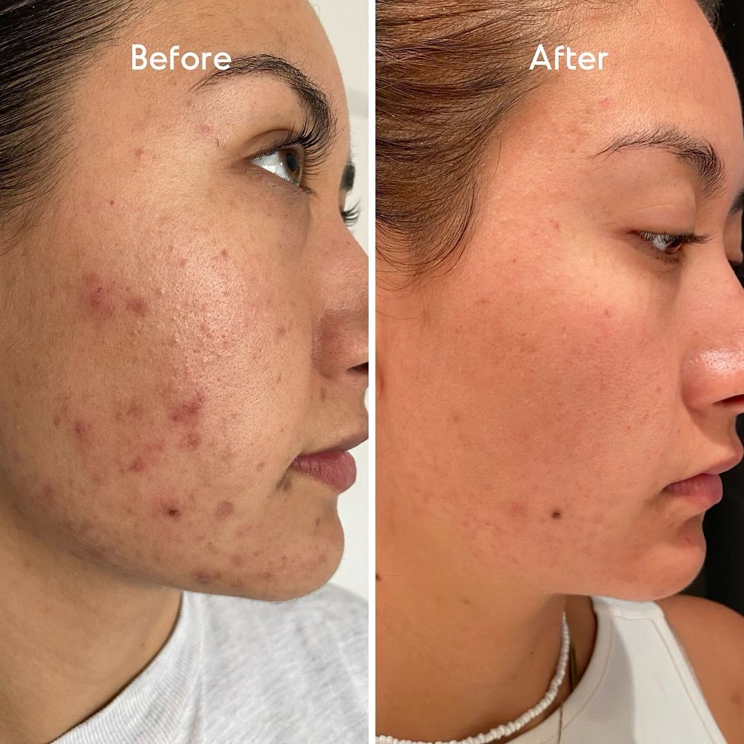 Before & After Photo Program