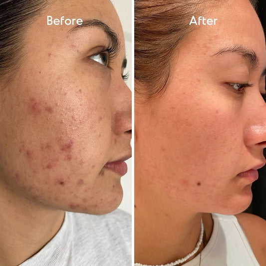 Before & After Photo Program
