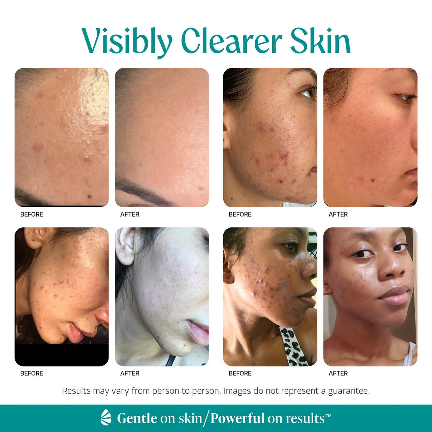 Facial Care Kit: Oily Skin